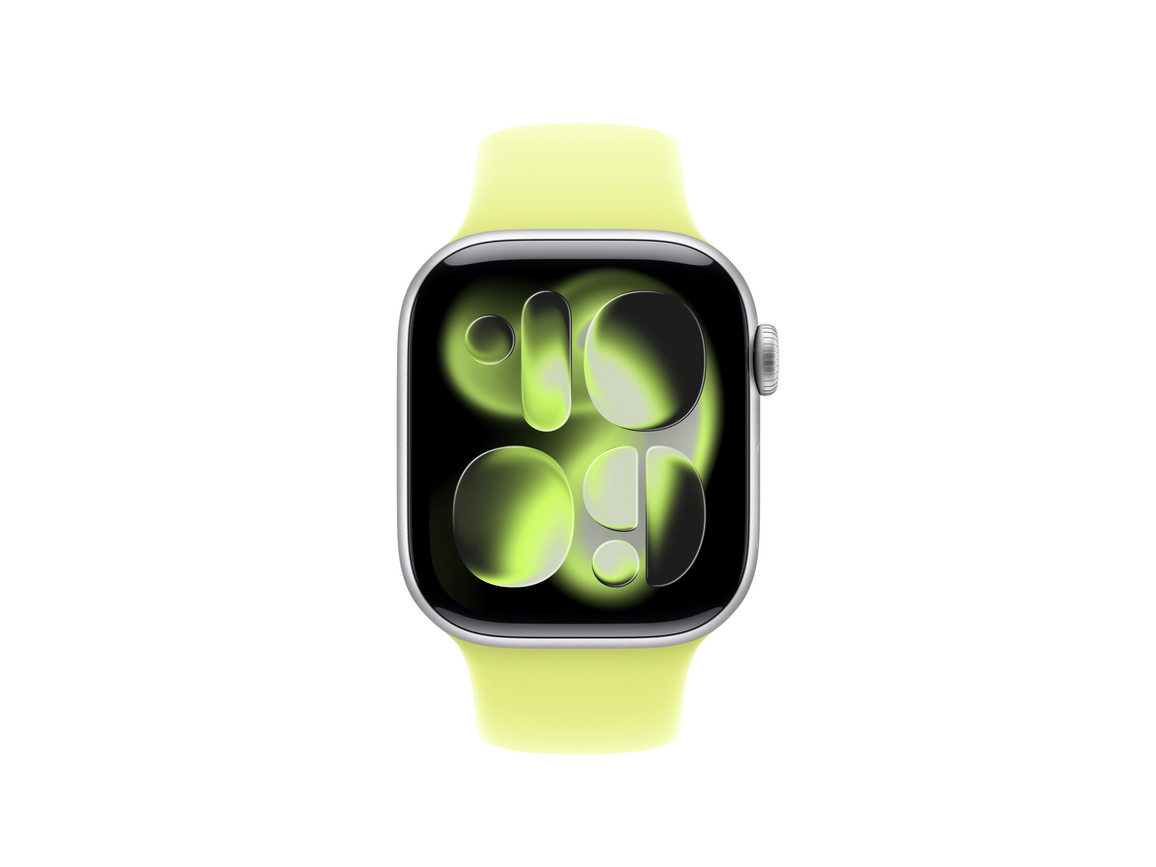 42 mm Sportarmband Neongelb - M/L