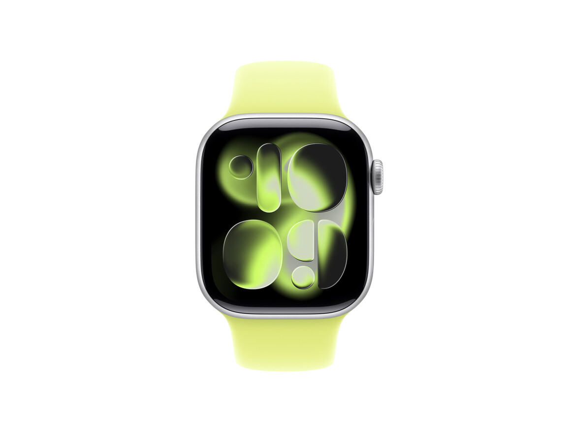 42 mm Sportarmband Neongelb - M/L